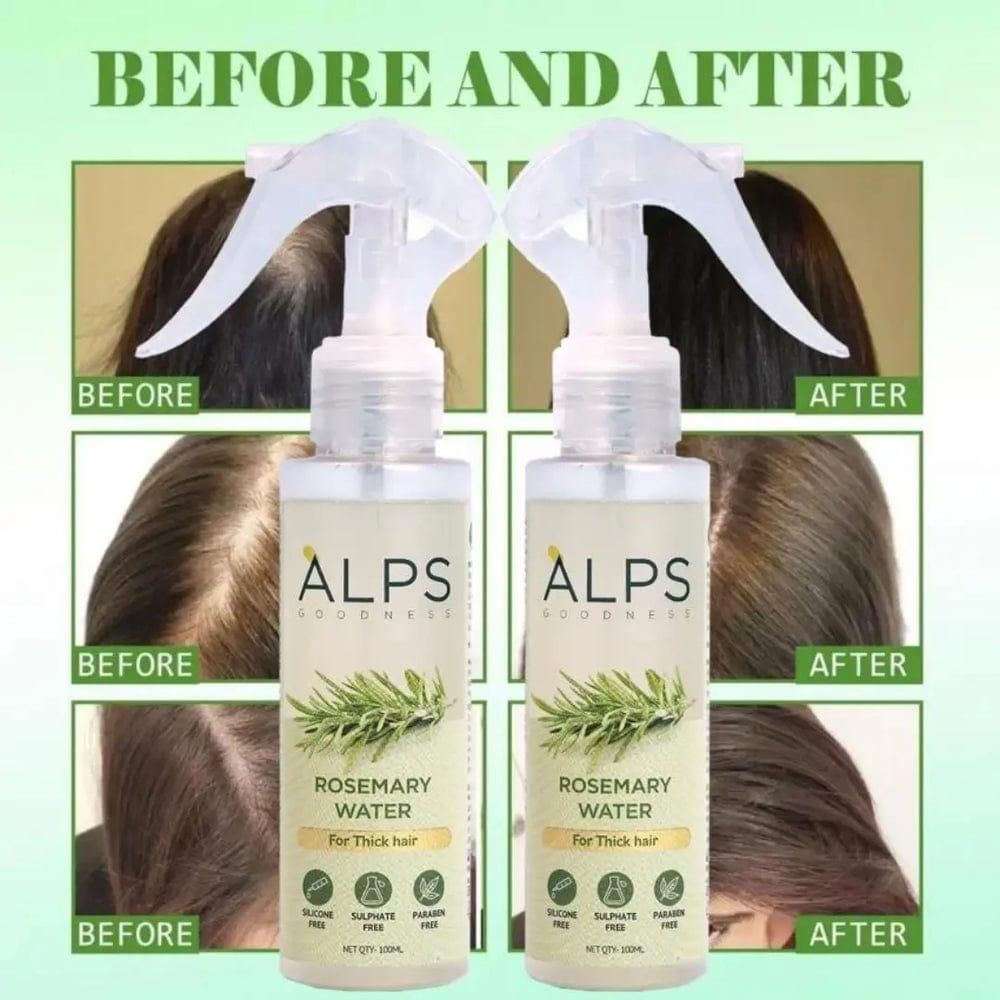 Buy 1 Get 2 Free Rosemary Water, Hair Spray For Regrowth