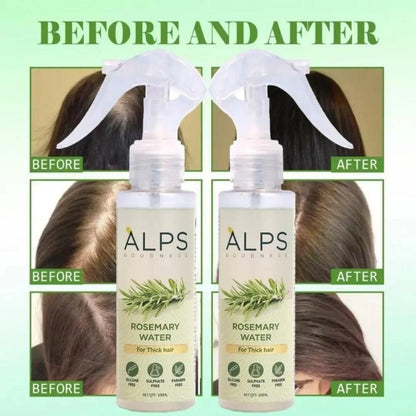 Buy 1 Get 2 Free Rosemary Water, Hair Spray For Regrowth